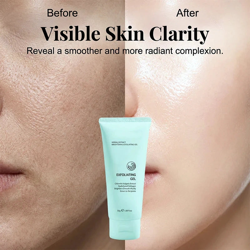 🥳2026 HOT SALE🥳💞50K+ SOLD!💥👵🌸 50% OFF!Herbal Extract Brightening Exfoliating Gel